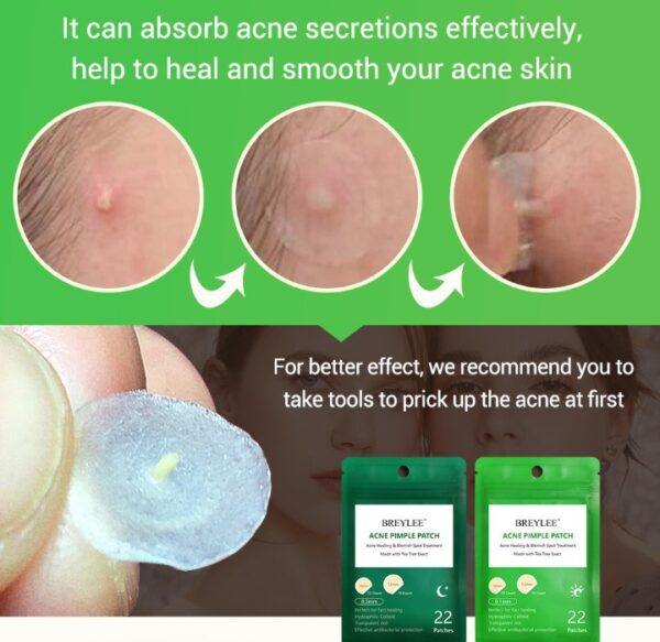 Ultra Thin Tea Tree Acne Patch Fades - Image 3