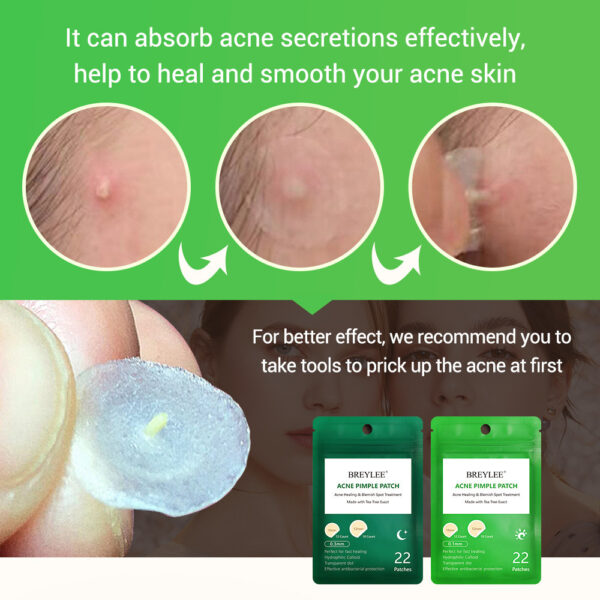 Ultra Thin Tea Tree Acne Patch Fades - Image 9