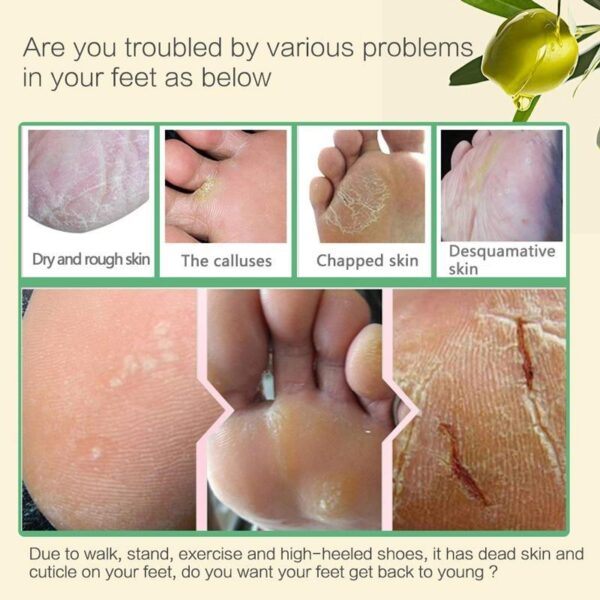 Aloe Vera Foot Peeling Mask - Image 4